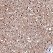 NBP1-93974 - TMEM127