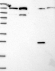 NBP1-93974 - TMEM127