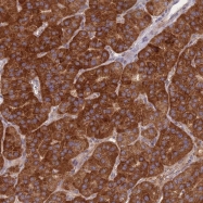 NBP1-94039 - TMEM144