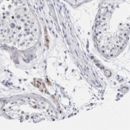 NBP1-93475 - TMEM146