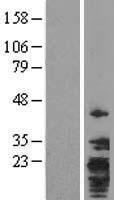NBL1-17019 - TMEM147 Lysate