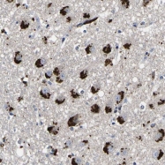 NBP1-93943 - TMEM149