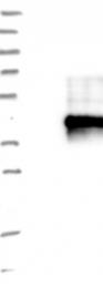 NBP1-93943 - TMEM149