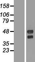 NBL1-17024 - TMEM151A Lysate