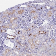 NBP1-93488 - TMEM161B