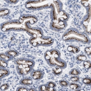 NBP1-81974 - TMEM17