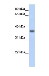 NBP1-54600 - TMEM173 / STING