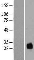 NBL1-17039 - TMEM174 Lysate