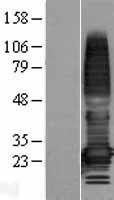NBL1-17041 - TMEM176A Lysate