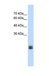 NBP1-69634 - TMEM178