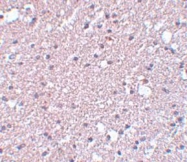 NBP1-77142 - TMEM184A