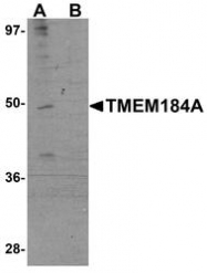 NBP1-77142 - TMEM184A