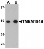 NBP1-77143 - TMEM184B