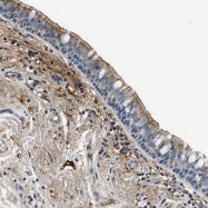 NBP1-88452 - TMEM186