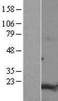 NBL1-17050 - TMEM188 Lysate