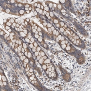 NBP1-88467 - TMEM199
