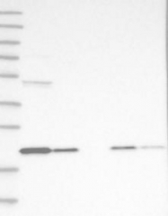 NBP1-88467 - TMEM199