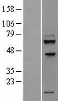 NBL1-17056 - TMEM200A Lysate
