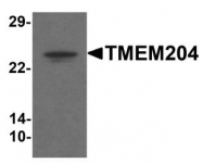 NBP1-77069 - TMEM204 / CLP24
