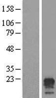 NBL1-17059 - TMEM204 Lysate