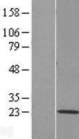 NBL1-17060 - TMEM205 Lysate