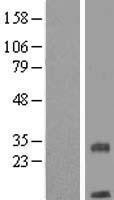 NBL1-17063 - TMEM208 Lysate