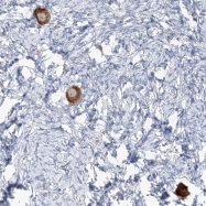 NBP1-94004 - TMEM209