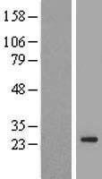NBL1-17067 - TMEM222 Lysate