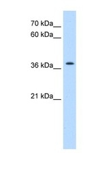 NBP1-59474 - TMEM30A / CDC50A