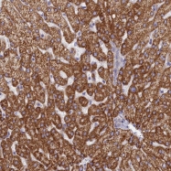 NBP1-85718 - TMEM30B / CDC50B