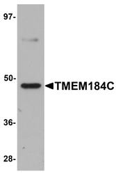 NBP1-77144 - TMEM184C / TMEM34