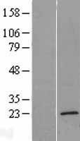 NBL1-17074 - TMEM35 Lysate