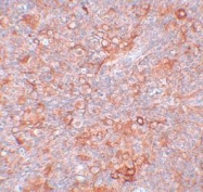 NBP1-77093 - TMEM38B
