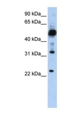 NBP1-59976 - TMEM38B