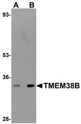 NBP1-77093 - TMEM38B