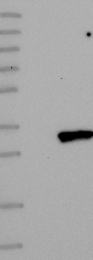 NBP1-88803 - TMEM38B