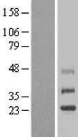 NBL1-17076 - TMEM38B Lysate
