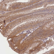 NBP1-83813 - TMEM39A