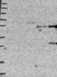 NBP1-83868 - TMEM39B