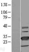 NBL1-17078 - TMEM41A Lysate