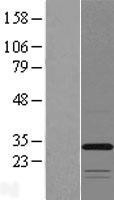 NBL1-17089 - TMEM53 Lysate
