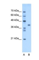 NBP1-69576 - TMEM59L