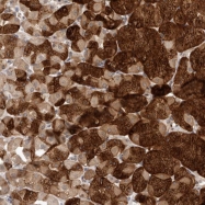 NBP1-85970 - TMEM65