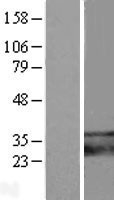 NBL1-17098 - TMEM66 Lysate