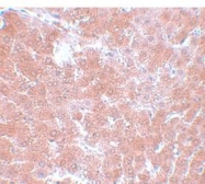 NBP1-77131 - TMEM70