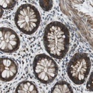 NBP1-83546 - TMEM74