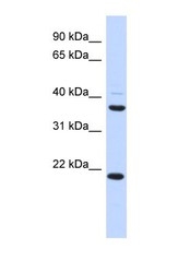 NBP1-60092 - TMEM74