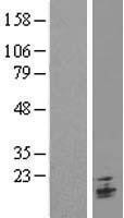 NBL1-17113 - TMEM9B Lysate