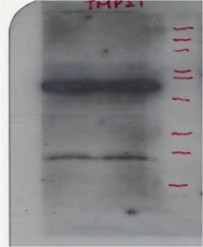 NB110-57586 - TMED10 / TMP21
