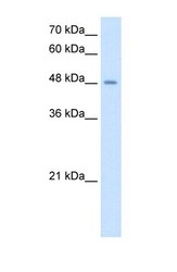 NBP1-62545 - TMPRSS11D